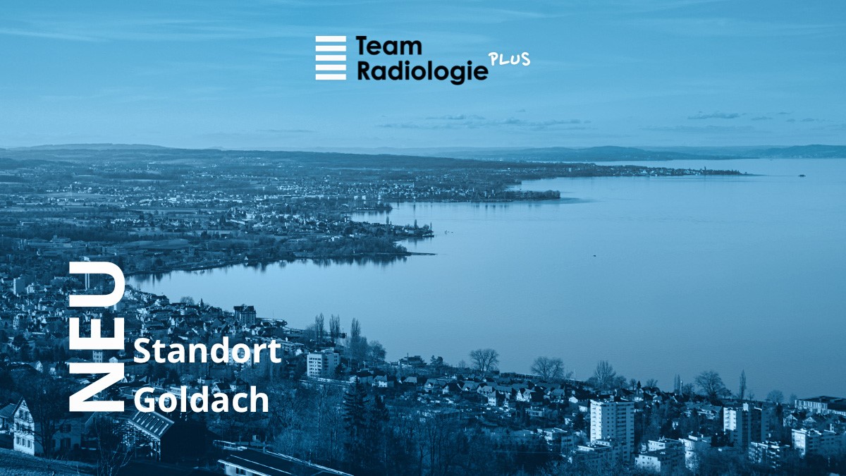 Goldach Start